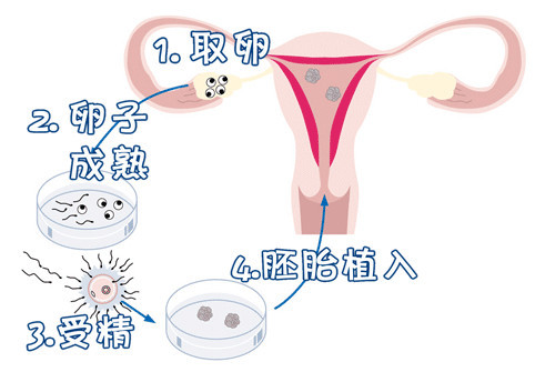 王建国